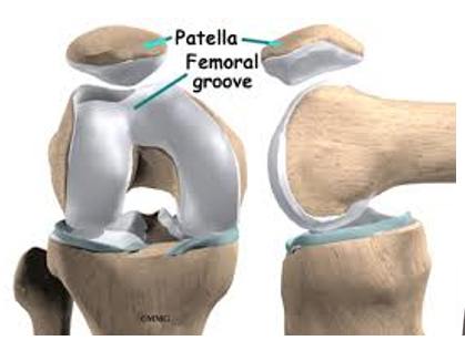 Arthroscopic Lateral Release for Patellofemoral Osteoarthritis